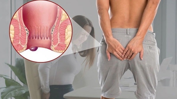 Ngứa vùng hậu môn do nguyên nhân bệnh lý