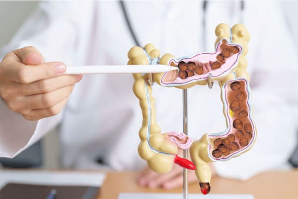 Tìm hiểu về bệnh táo bón